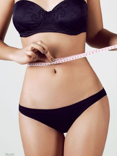 Liposuction Patient 01 Before