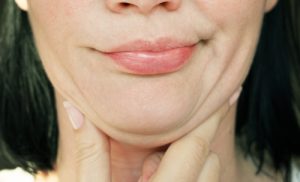 a woman with a second chin